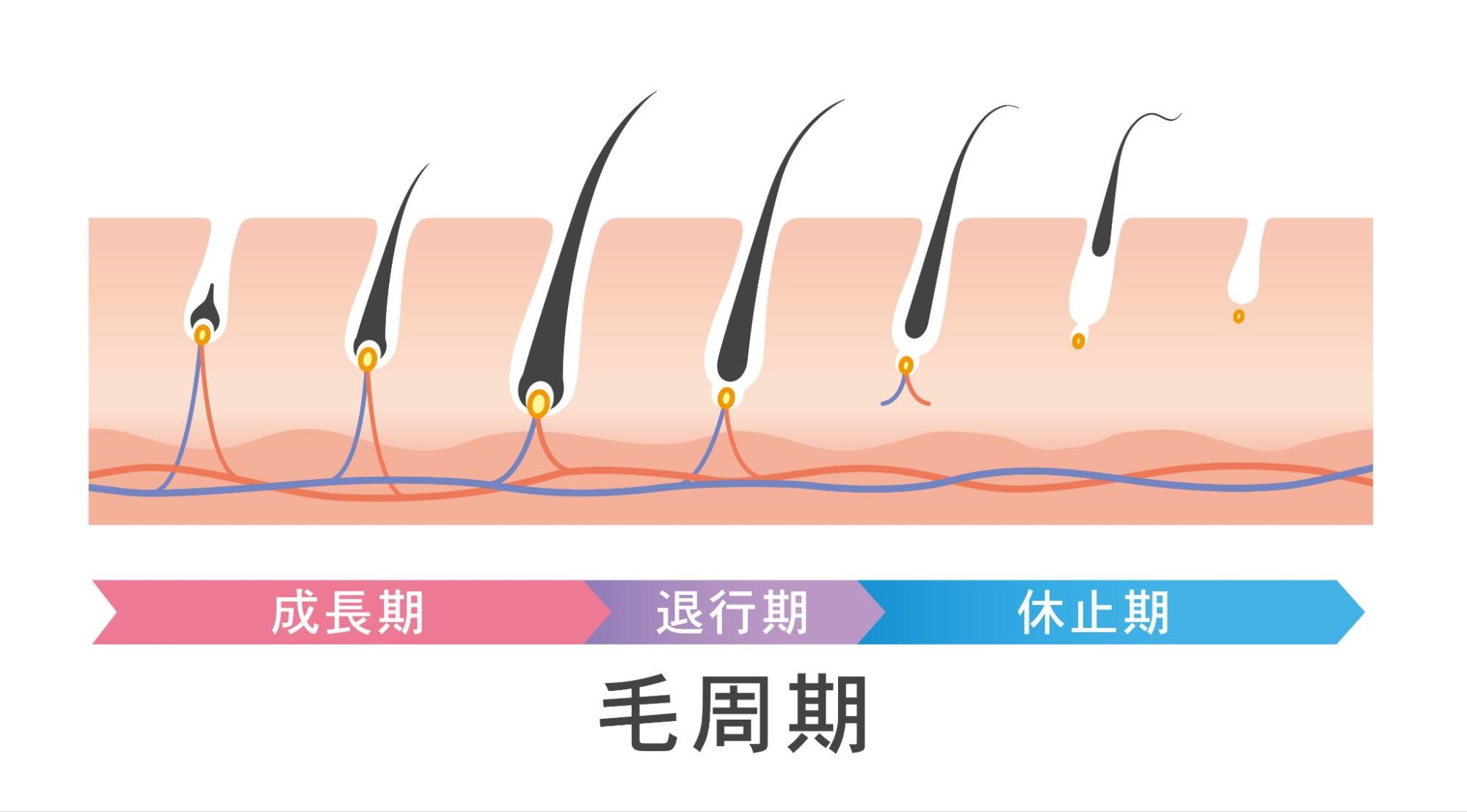 家庭用脱毛器　脱毛　人気　ランキング　おすすめ